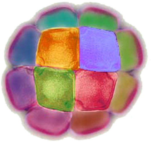 polline di Mimosaceae - colori artificiali